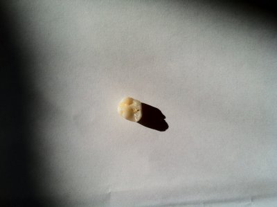 js baby tooth.JPG
