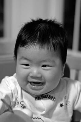Big Gummy Smile