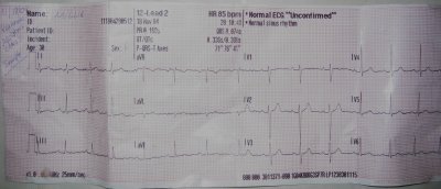12 LEAD EKG 238.jpg