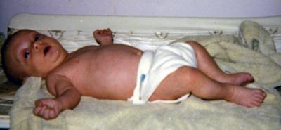 Adam - 1 month