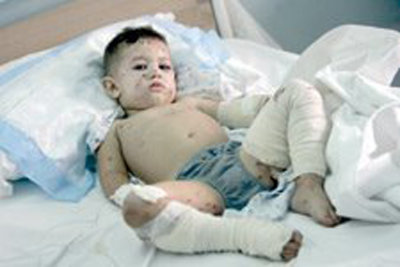 War Comes to Lebanon's Children
