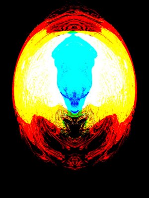scan cerebro