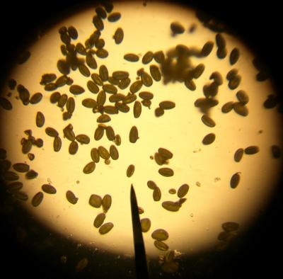 Bermuda Sorrel pollen, 40x