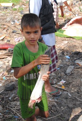 Indonesia 1 5 2012 175 Lombok Boy with Leg