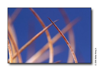 Prickly Encounters