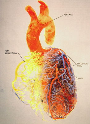 coronaries.jpg