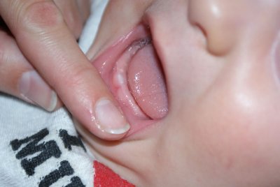 my first tooth!