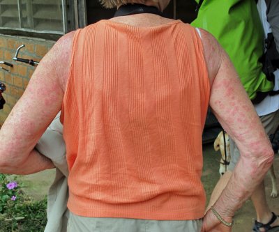 What the Kaburi flies did to Leila while she was waiting for the Sun Conures to appear