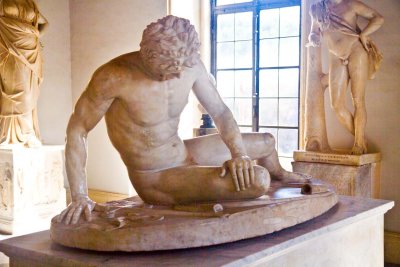 Dying Gaul