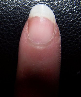 Self Portrait - Fingernail - July 11 2008.jpg