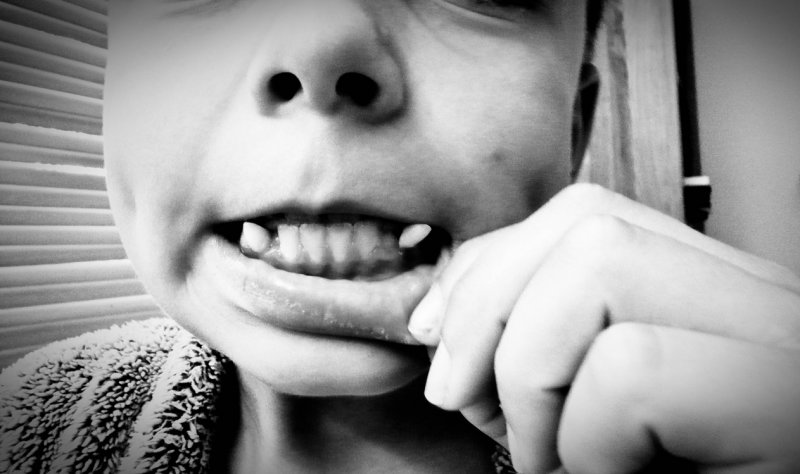 Sunday 27 July - Gruffalo teeth!