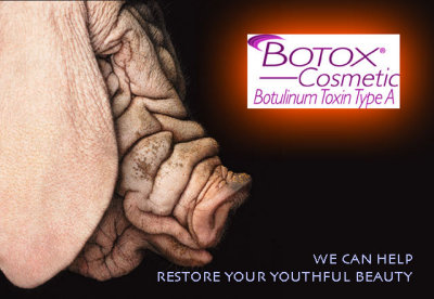 Botox.jpg
