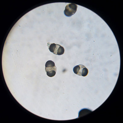 Tallpollenkornen i mikroskopet - The pine pollen in the microscope