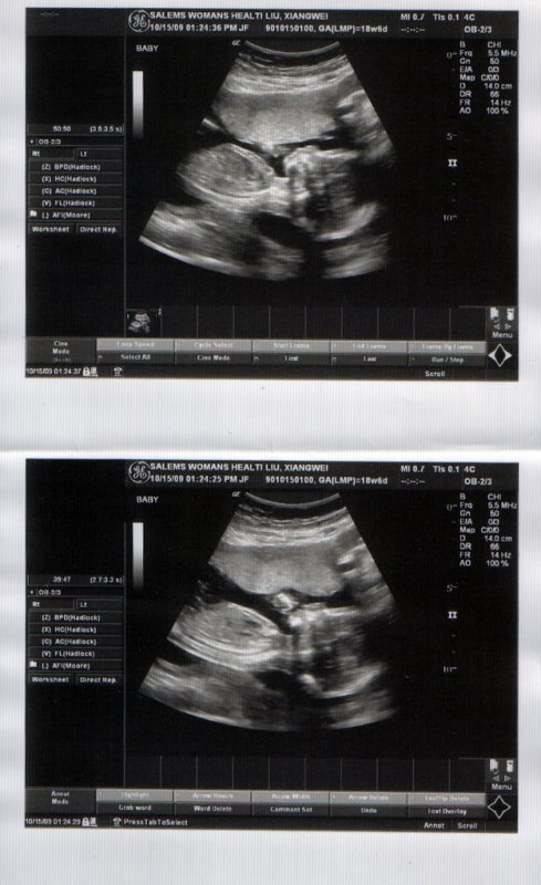 baby-19.jpg