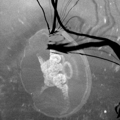 35bw