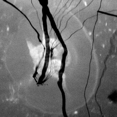36bw