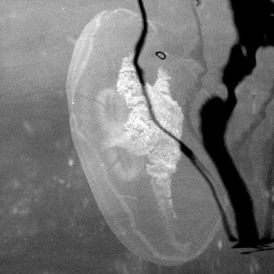 32bw
