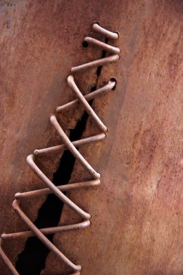 Suture