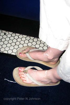 Susan T stepped on a mayonnaise packet - this is the result on Rachel's foot