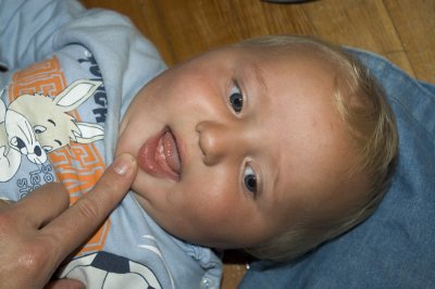 Two Teeth!