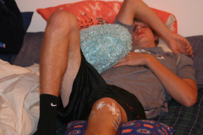 adam 3 days post surgery
