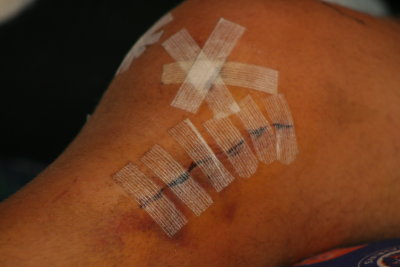dr. favorito's work