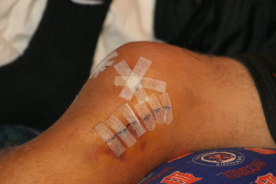 adam's left knee