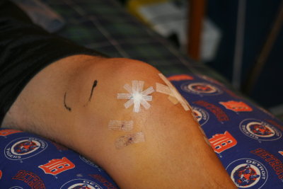 left knee