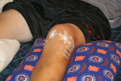 porkchop 3 days after surgery