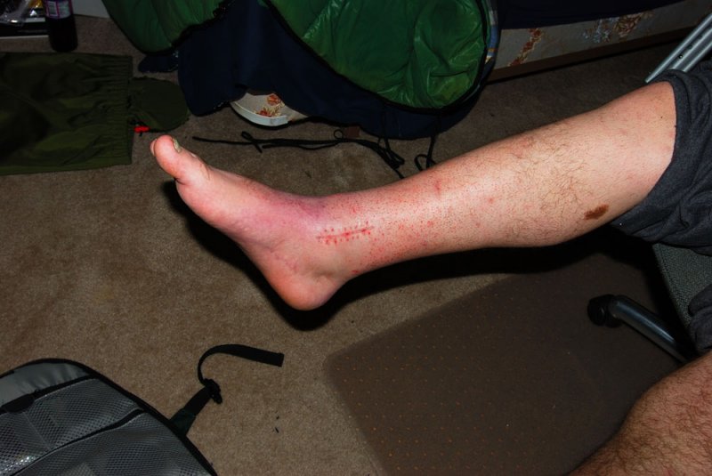 inner scar0001.JPG