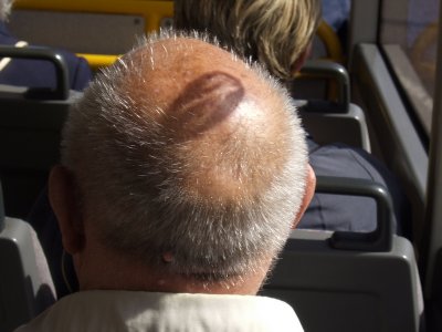 Not really, The sun was shining through the Bus window and projecting a No Smoking symbol on to this poor mans head. well it made me laugh but then again I don't get out enough!!