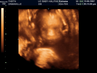Jordyn!