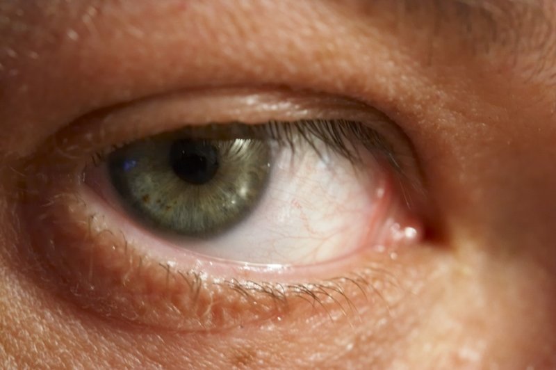 Cyril Reijasse<br>     Eye see U !!!