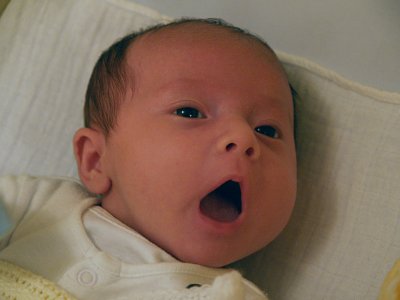 Yawn