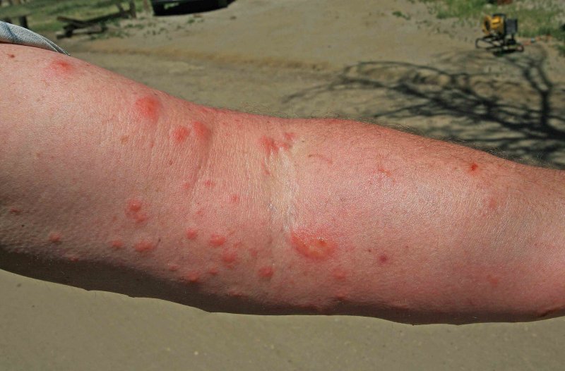  Poison Oak!!! Lots Of It Near Mexican Border