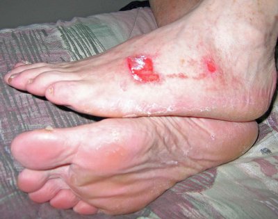  Doctor Bob's Feet  PCT 2005