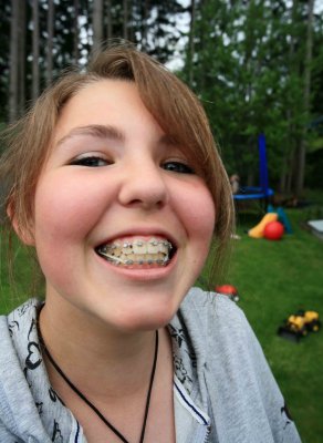  My Daughter  Angela and her new Braces