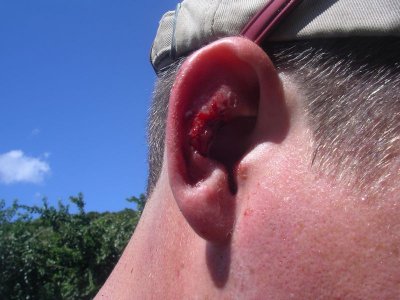 Bloody ear from rock.JPG