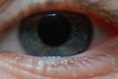 blue-eye.jpg