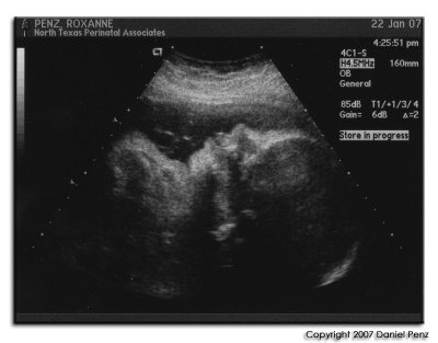 January 2007 POD