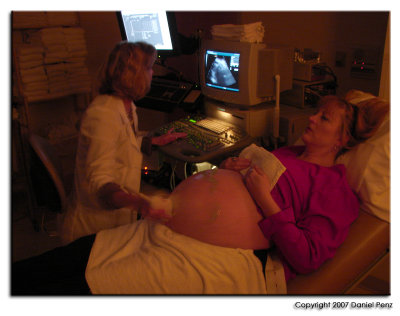 Ultrasound Scans for Perry Anthony