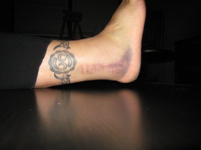 black and blue