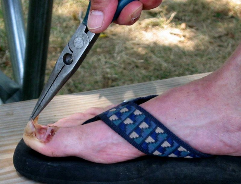 Jans toenail