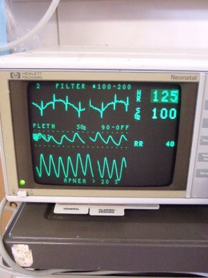 Heartbeat seems normal