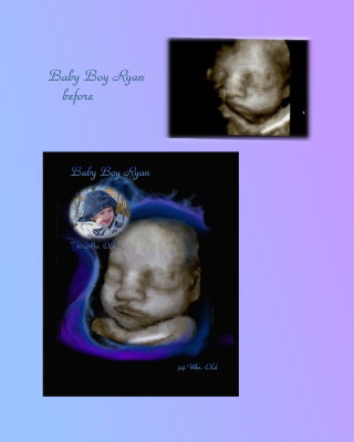 Baby Bay Ryan  before.jpg