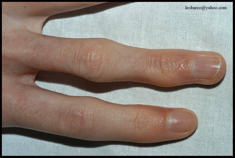 MORPHEA_02.JPG