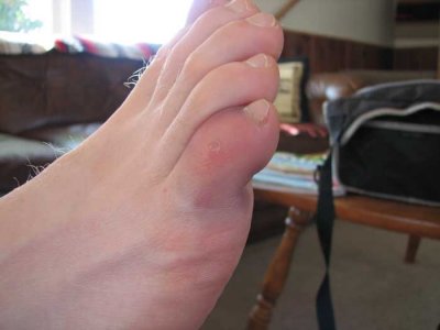 hashed-war-wound.jpg