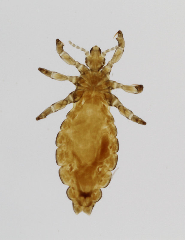 Pediculus-humanus-v-humanus.jpg