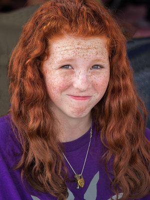 Red Hair & Freckles