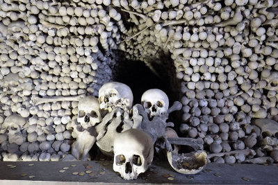 Bone display